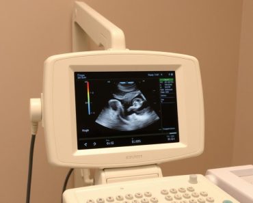 УЗИ аппарат: как работает и почему он незаменим в современной медицине