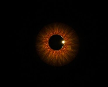 Хориоидальная меланома: что важно знать, пока не поздно