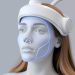 RF‑моделирование овала лица на аппарате FaceTite: что это, как работает и стоит ли пробовать