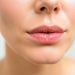 Уход за кожей вокруг рта: профилактика морщин